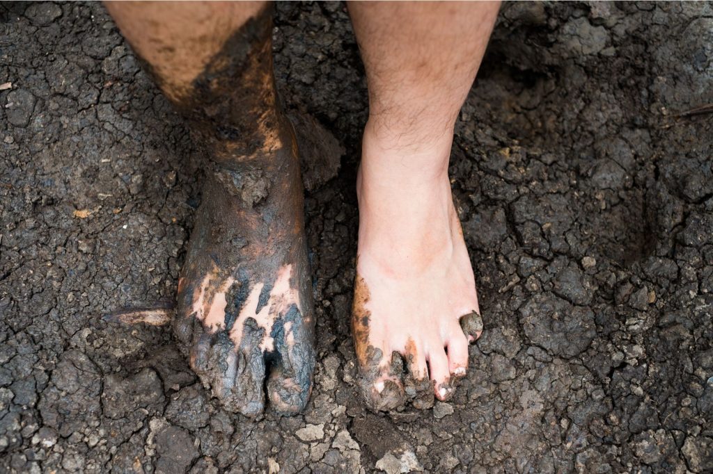 Twee voeten in de modder, één vuil en één schoon - symboliek voor spiritueel ontwaken, wat vaak voelt als ploeteren door de modder.